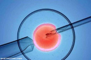 高齡二胎